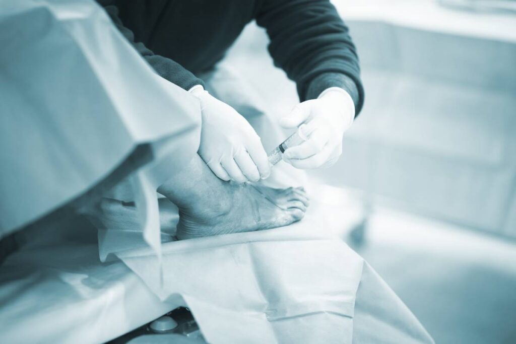Local Anesthesia Injections by Orthopedic Surgeons