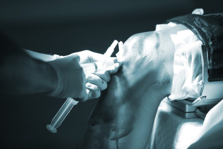 Intraarticular Injections